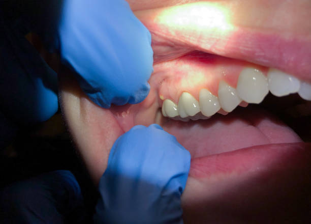 Best Pediatric Emergency Dentist in Gladstone, MI